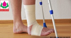 bảo hiểm tai nạn con người bảo minh